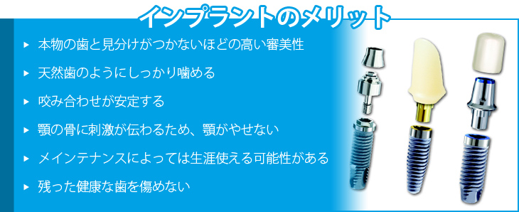 インプラントのメリット